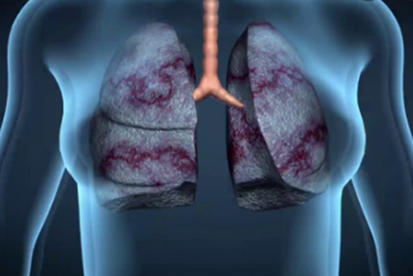 1662365855460942.png image.png